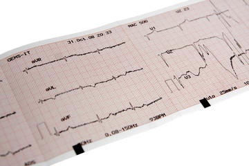 Electrocardiogram paper