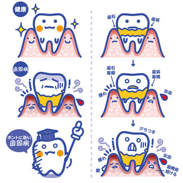 セイカツpickup/歯周病（青罫）