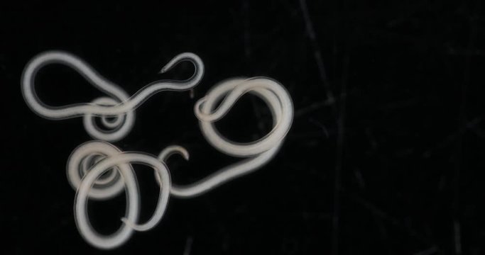 Ascariasis is a disease caused by the parasitic roundworm Ascaris lumbricoides for education in laboratories.