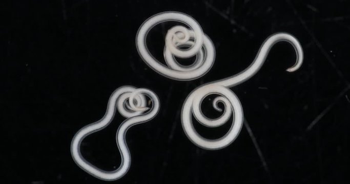 Ascariasis is a disease caused by the parasitic roundworm Ascaris lumbricoides for education in laboratories.