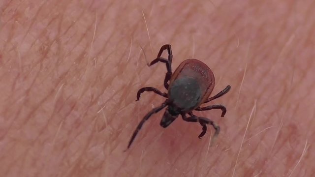 Zecke l&auml;uft &uuml;ber menschliche Haut