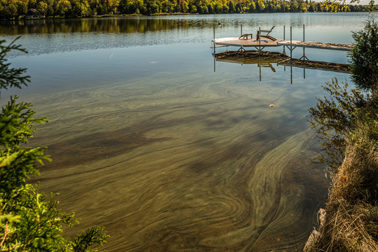 &Eacute;closion de cyanobact&eacute;rie sur le lac