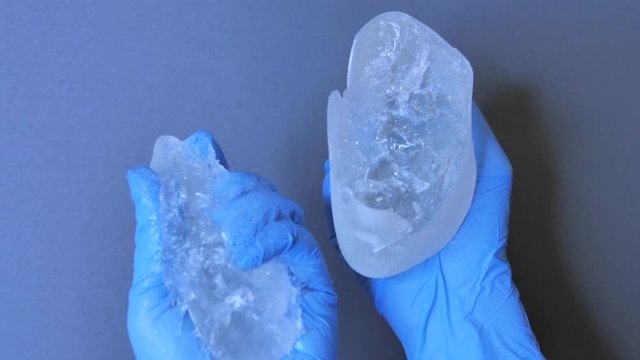 Silicone implant rupture. Close-up shot of breast implant content.