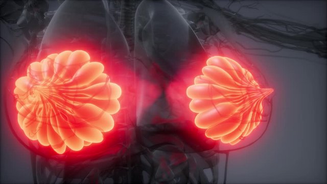3d rendered medically accurate illustration of an obese womens mammary glands
