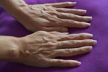 Fototapeta premium Female hands with ugly veins and long nails on purple background.
