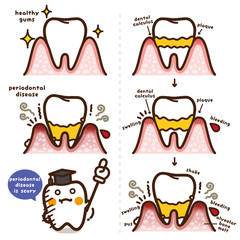 セイカツpickup/歯周病 英語版