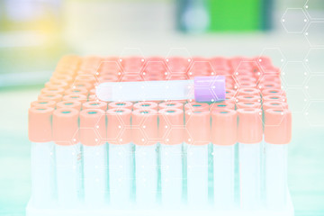 Healthy.science, chemistry, biology, medicine and people concept. close up of doctor holding test tube with blood sample making research in clinical laboratory.Doctor analyzes tubes of blood in a lab.