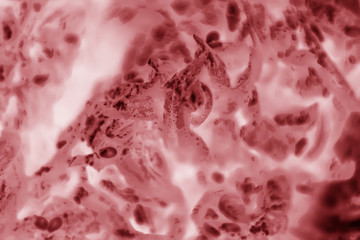 HeLa cervical cancer cells stained with Coomassie Blue under a microscope.