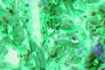 PC-3 human prostate cancer cells stained with blue Coomassie, under a differential interference...