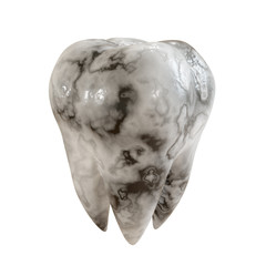 Caries patient tooth on a white background. Tooth disease. 3D Illustration.