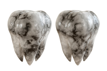 Caries patient tooth on a white background. Tooth disease. 3D Illustration.