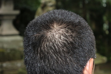 坊主頭（森の神社の境内、夏休み）a close‐cropped head, Buzz cut