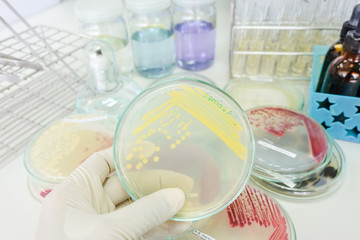 colony of bacteria in petridish with microbiology concept