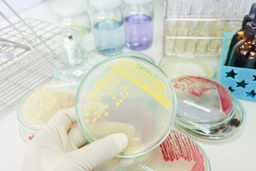 colony of bacteria in petridish with microbiology concept