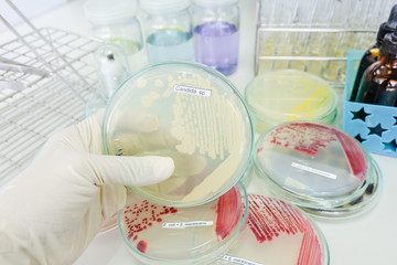 colony of bacteria in petridish with microbiology concept