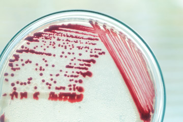 colony of bacteria in petridish