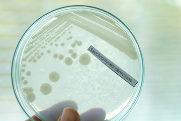colony of bacteria in petridish