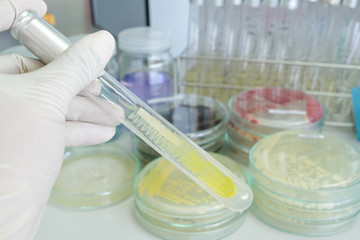 colony of bacteria in test tube