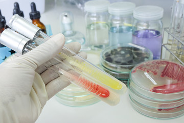 colony of bacteria in test tube