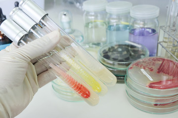 colony of bacteria in test tube