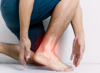 Fototapeta Inflammation bone ankle of humans with inflammation obraz