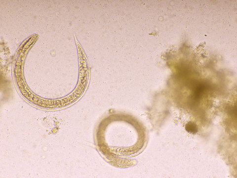 Strongyloides stercoralis or threadworm in human stool, analyze by microscope, original magnification 400x