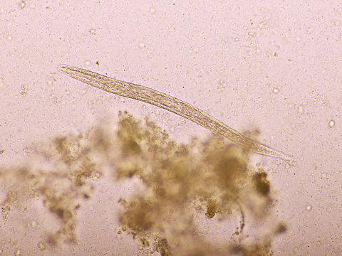 Strongyloides stercoralis or threadworm in human stool, analyze by microscope, original magnification 400x