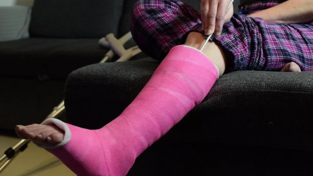 Foot itching under plaster cast. Woman scratching pink orthopedic cast with knitting needle. 