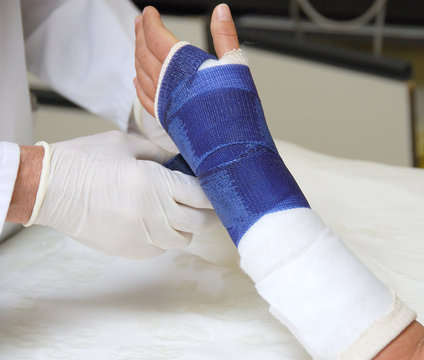 Doctor putting plaster on broken woman's hand