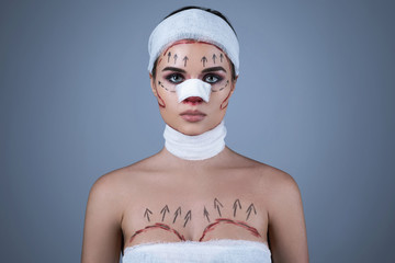 Model in image of plastic surgery victim