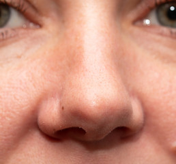 woman's nose with clean fair skin