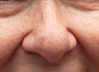 woman's nose with clean fair skin