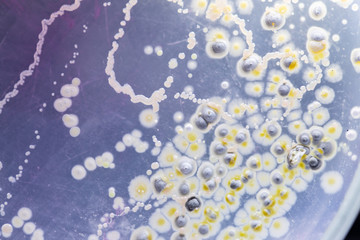 Mold Beautiful, Colony of Characteristics of Fungus (Mold) in culture medium plate from laboratory microbiology.