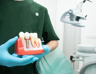 Male dentist carrying a sample of dental implants.