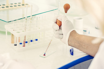 Laboratory assistant in the laboratory analyzing the blood sample, closeup. 2019