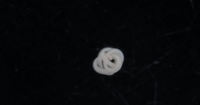 Ascariasis is a disease caused by the parasitic roundworm Ascaris lumbricoides for education in laboratories.