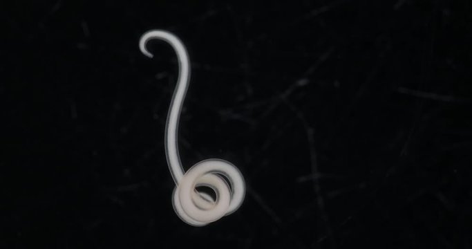 Ascariasis is a disease caused by the parasitic roundworm Ascaris lumbricoides for education in laboratories.