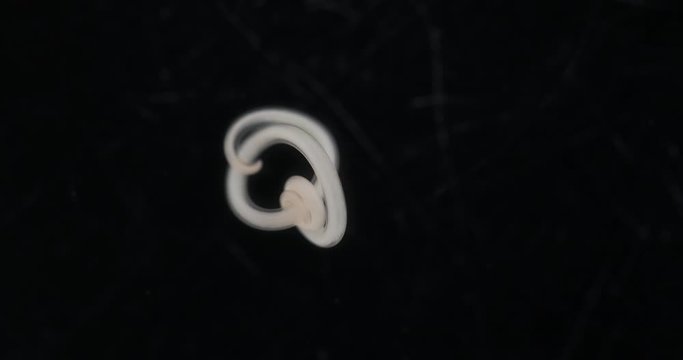 Ascariasis is a disease caused by the parasitic roundworm Ascaris lumbricoides for education in laboratories.