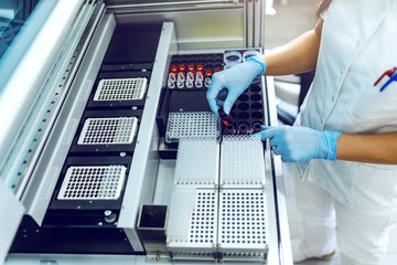Cropped picture of lab assistant putting flasks with urine samples into machine.