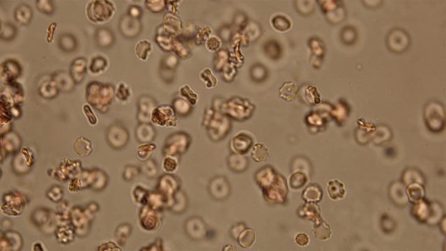 Blood under a microscope, the movement of dead and damaged cells in human blood that have lost their shape and color 4K