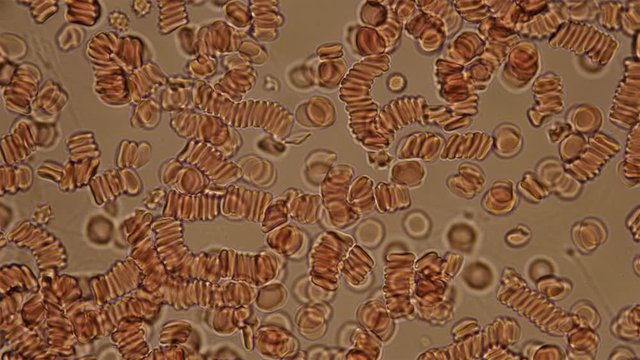 Blood under a microscope, adhering red blood cells in clotted blood, they are also called the effect of coin columns. In the blood of a healthy person, this is permissible. 4K