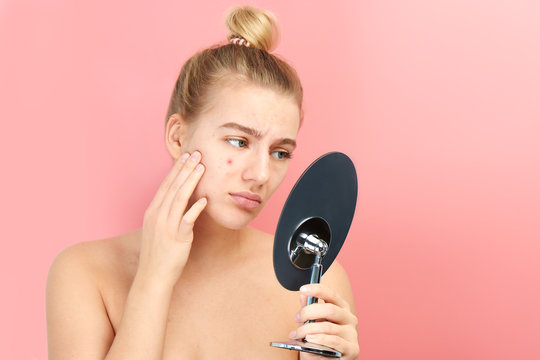 Upset girl looks in the mirror at her problem skin with red acne and post-acne isolated on a pink background
