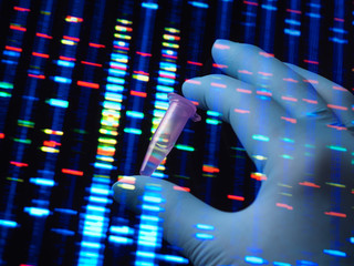 DNA Research, DNA sample held up to a screen with the genetic results.
