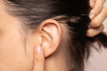 Brunette woman touching ear with mole