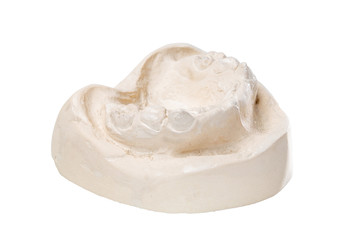 cast of teeth