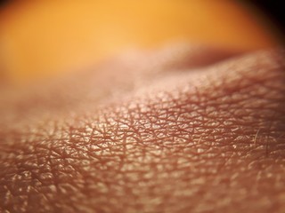 closeup skin of human hand.Medicine and dermatology concept. Details of human skin background for...