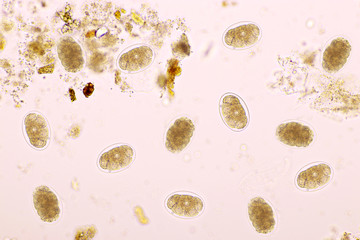 Eggs of Hookworm in human stool, analyze by microscope, original magnification 400x