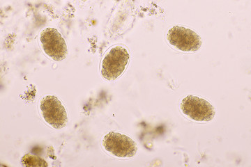 Eggs of Hookworm in human stool, analyze by microscope, original magnification 400x