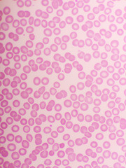 Red blood cells in blood smear, Wright-Giemsa stain, analyze by microscope, 1000x