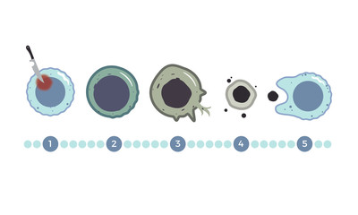 The many stages of Necrosis - Cell Death